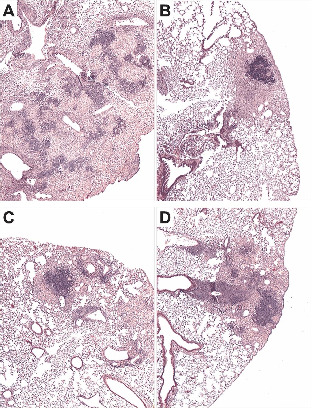 298 DELOGU ET AL. INFECT. IMMUN. FIG. 4. Histopathological analysis of lungs from vaccinated mice obtained 63 days following M. tuberculosis challenge.