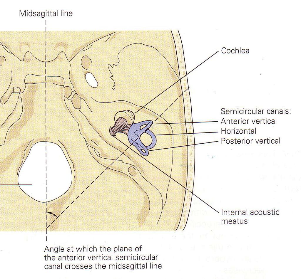 How Are the Hair Cell Stereocilia Moved in the Vestibular Sensory Organs?