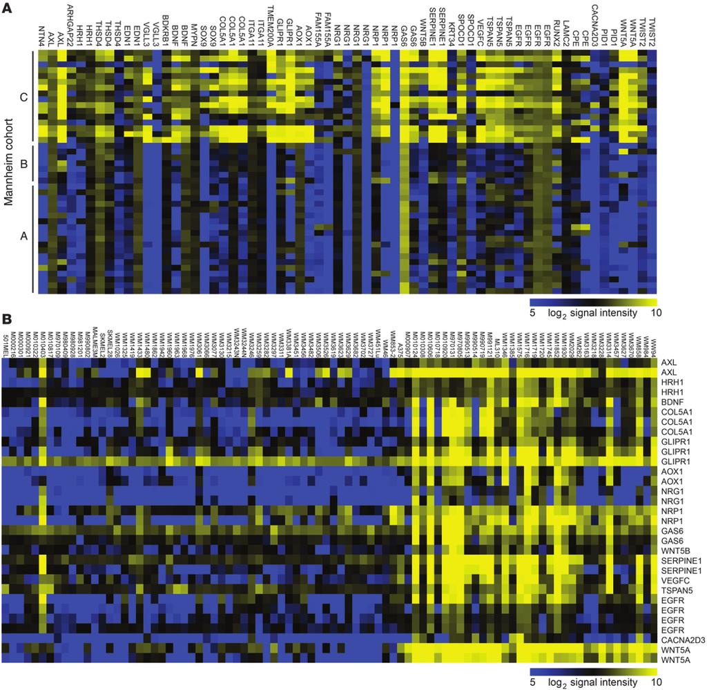 Figure 7 WNT5A is upregulated as part of a gene signature associated with clinical phenotypes in melanoma.