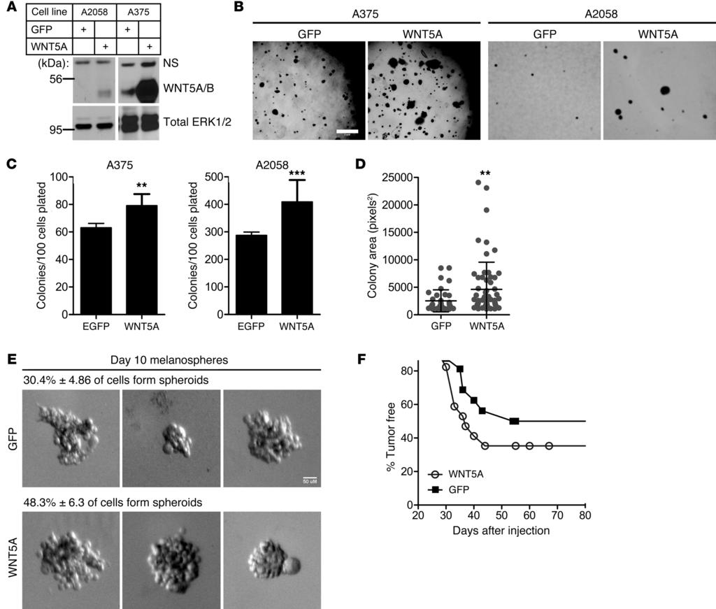 Figure 4 WNT5A overexpression enhances melanoma cell proliferation.