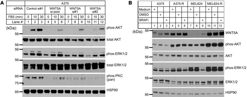 Figure 5 WNT5A enhances AKT pathway activity in melanoma. (A and B) Cell lysates analyzed by Western blotting.