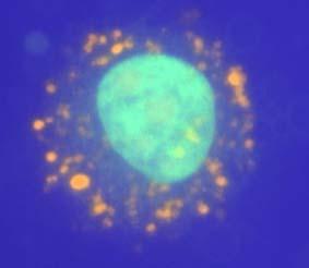 Exosomes visualized by