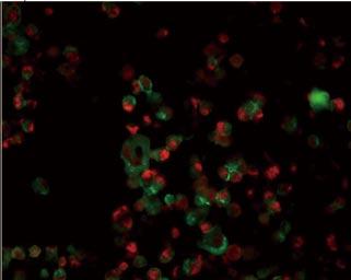 Cells are positive for vimentin (green), EpCAM (green) and PCNA (red). Both vimentin and EpCAM positive cells are positive for PCNA staining (merged) and proliferating. Scale bars are 50 μm.
