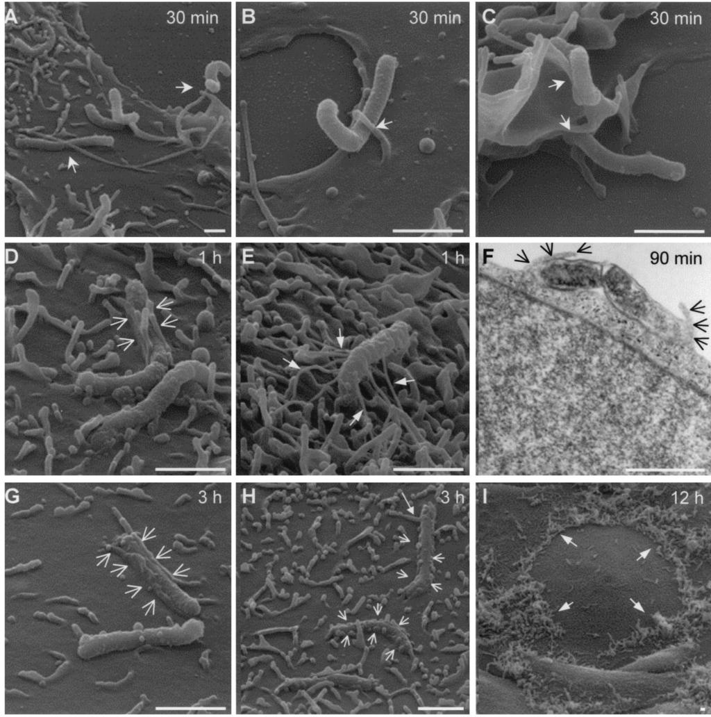 2112 KWOK ET AL. INFECT. IMMUN. FIG. 3. SEM and TEM analyses of H. pylori 26695 adherence to and entry into AGS cells. AGS cells were infected with H. pylori 26695 at an MOI of 100 for 12 h at 37 C.