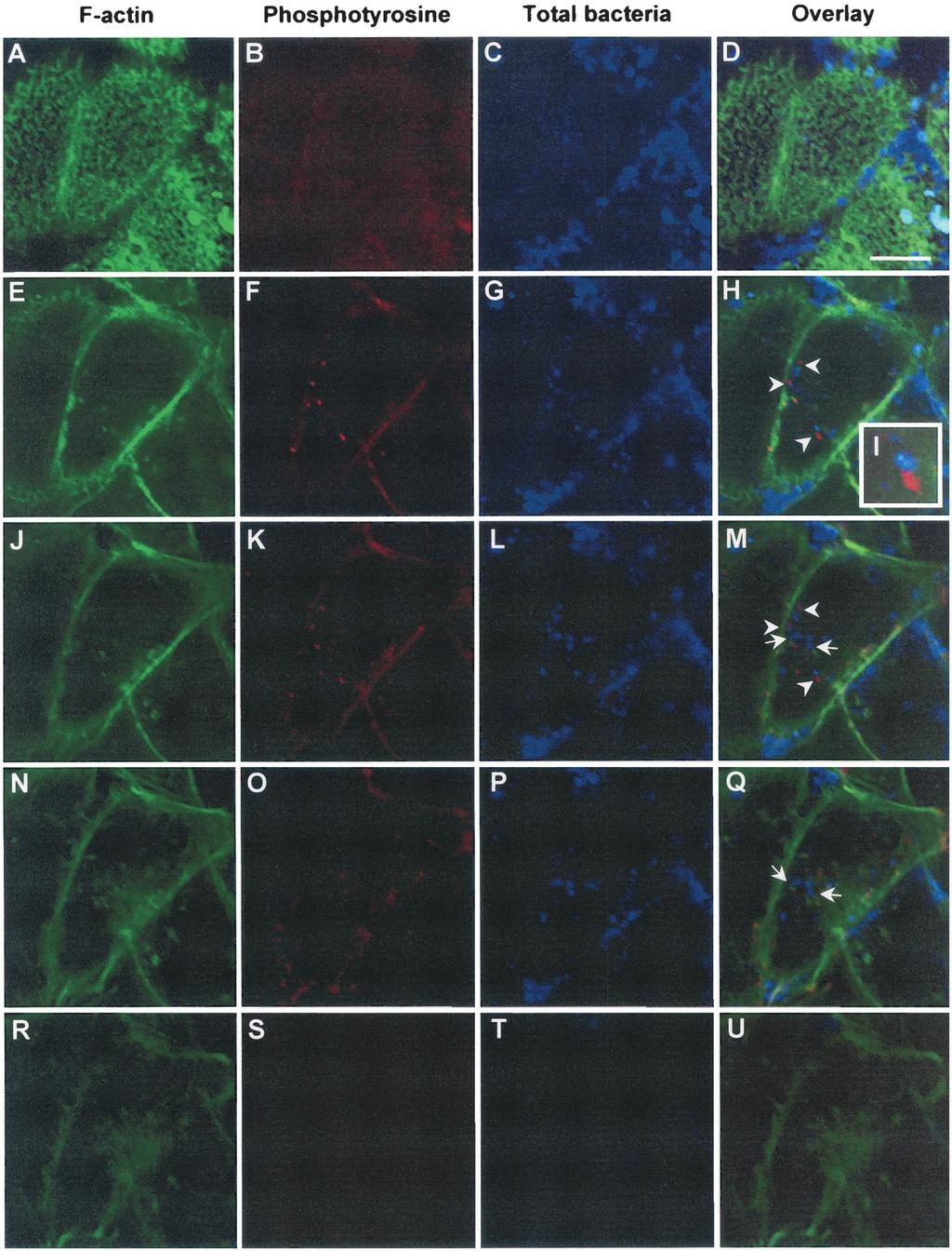 2114 KWOK ET AL. INFECT. IMMUN. FIG. 6. CLSM analysis of the spatial relationship among intracellular H. pylori, host actin cytoskeleton, and protein phosphotyrosine signals.