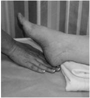 Start with high density foam (memory foam) for residents who turn themselves Add low air loss overlay For residents who have moist skin Dyspnea, obese, in pain, terminally ill Change to