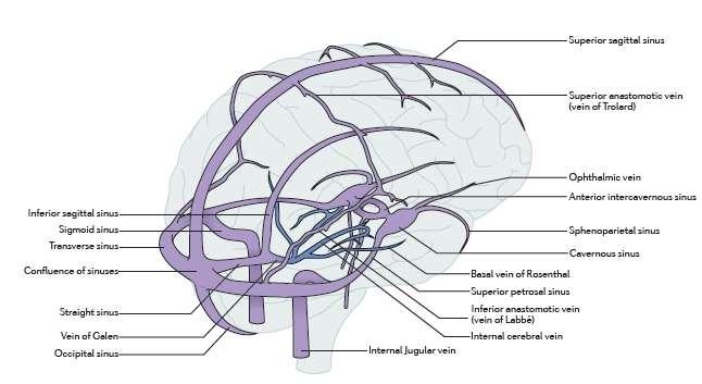 Introduction Symptoms and Findings headache (90%) Visual disturbances Papilledema (28 47%) Seizures (40 %)
