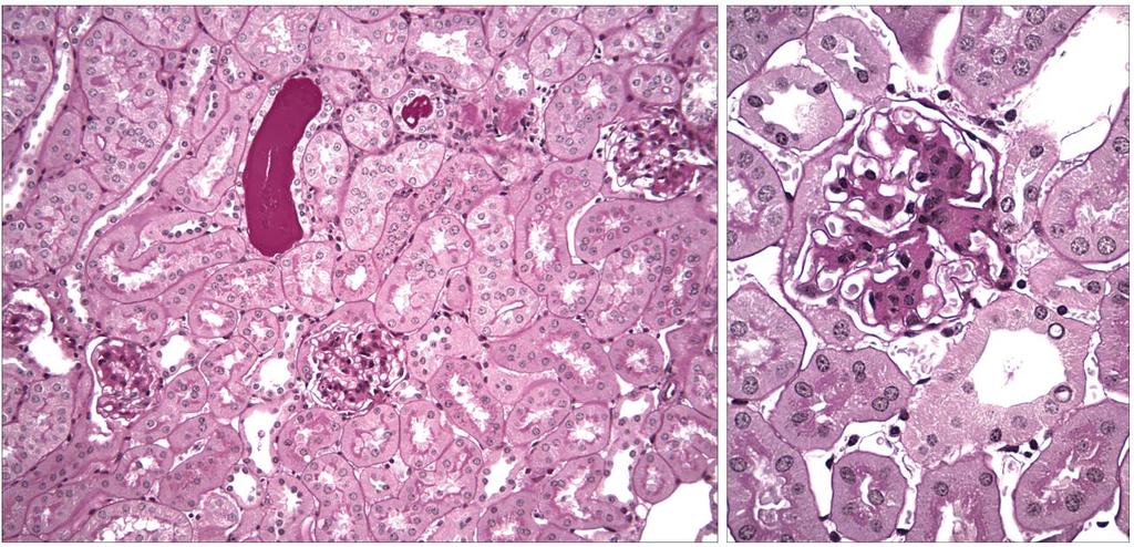 A: No histologic abnormalities were detected in FVB RKO mice (not shown).