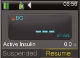 INSULIN PUMPI SUSPEND DELIVERY CGM I INTRODUCTION TO CONTINUOUS GLUCOSE MONITORING SECTION 8: SUSPEND DELIVERY Remember your pump is delivering basal insulin throughout every hour of the day.