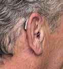 1 Selecting the right style: Hearing aids come in a wide
