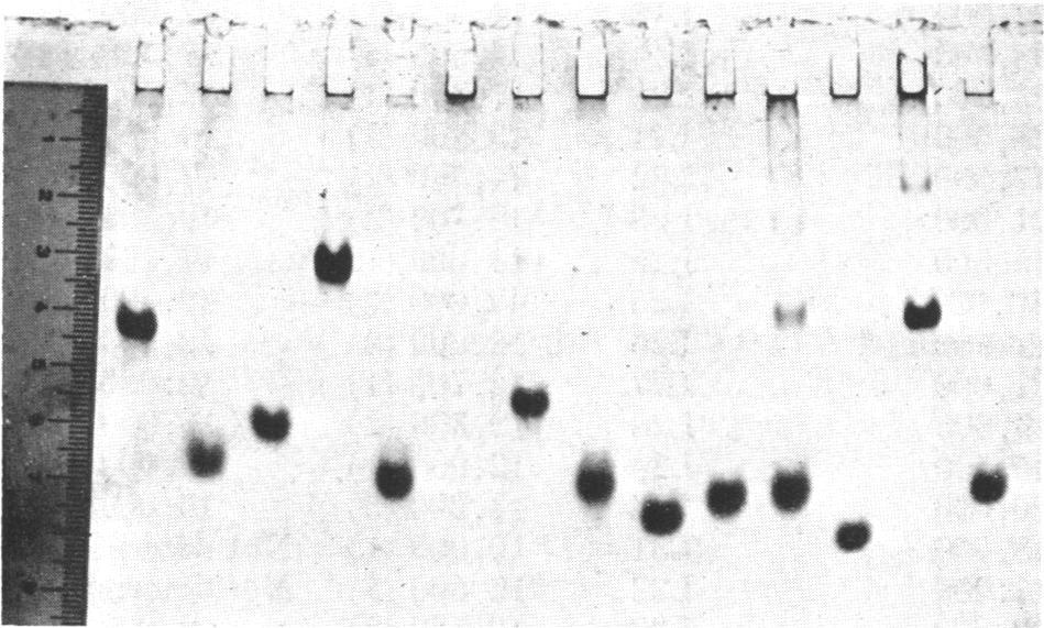 SDS-gel electrophoretic pattern of a ribosomal protein, showing monomer and probable di-, tri-, and tetramers; the molecular weights are indicated. TABLE 1.