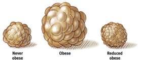 The Physiology of Obesity