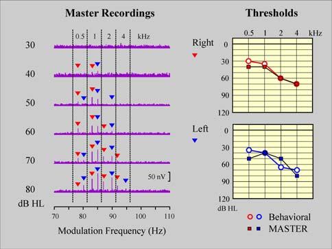 to a small response or EEG-noise levels larger than the expected response - do