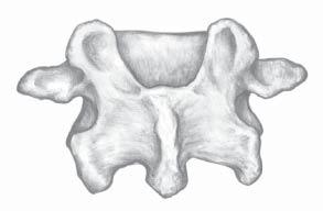 The entry point for each lumbar pedicle is at the intersection of a horizontal line bisecting the transverse