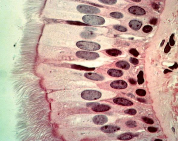Cilia Motile cytoplasmic hair like projections capable of moving fluid and particles along epithelal surfaces.