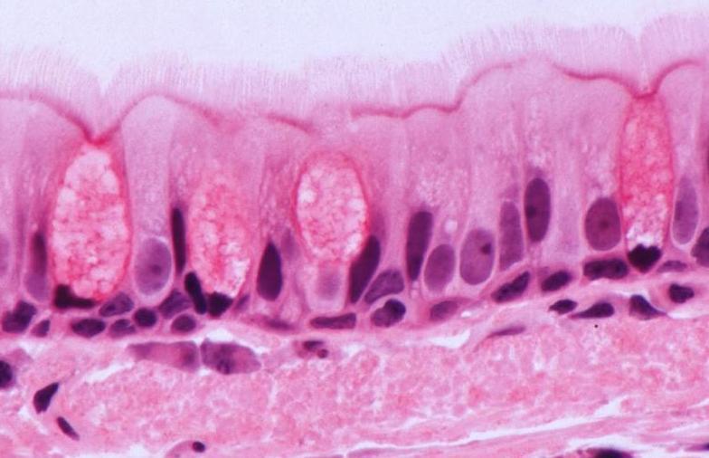 Pseudostratified Columnar Epithelium Ciliated with