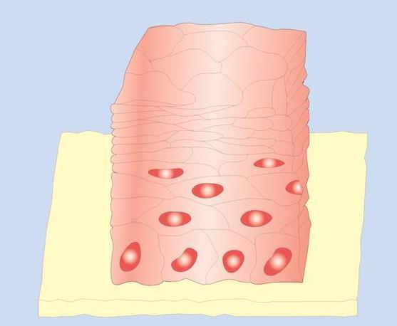 Stratified Squamous Epithelium Keratinized Structure: The surface cells are full of keratin and non-nucleated,