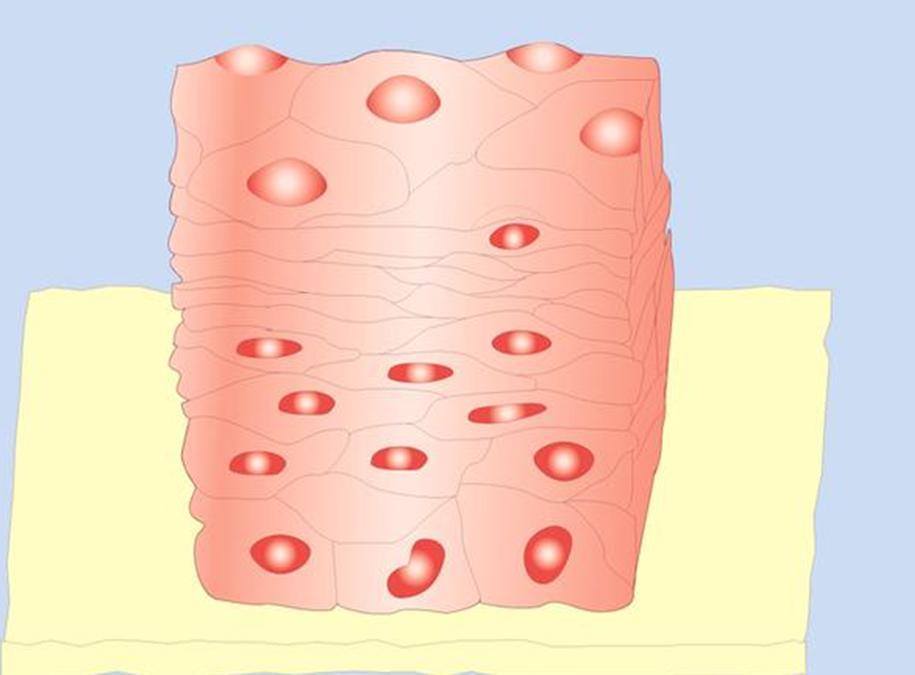 Stratified Squamous Non keratinized Epithelium Structure: Composed of several layers, basal cells are cuboidal or columnar and metabolically