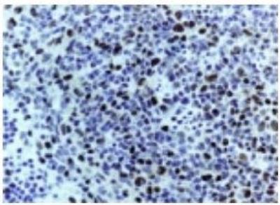 Images Immunohistochemistry-Paraffin: Caspase-3 Antibody - (active/cleaved) [NB100-56113] - Irradiated mouse spleen stained for Active/Cleaved Caspase-3 expression using NB100-56113 at 1:2000.