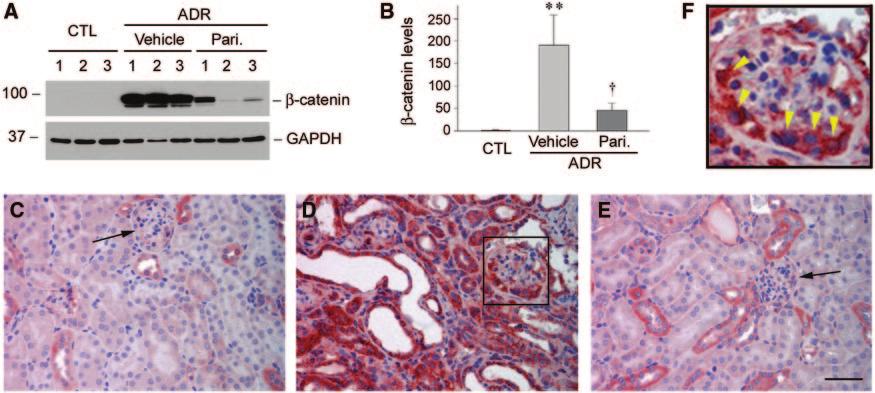 www.jasn.org BASIC RESEARCH Figure 6. Paricalcitol blocks renal -catenin accumulation and activation after ADR injury.