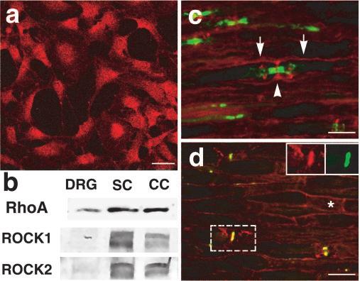 Melendez-Vasquez et al. Rho and ROCK Regulate Myelination J. Neurosci., April 21, 2004 24(16):3953 3963 3955 Figure 1. Expression of Rho by Schwann cells in vitro and in vivo.
