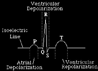 The first deflection is the relatively slow and weak depolarization of the atria, called a P wave, which occurs just before the atria contract.