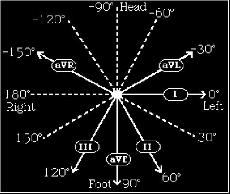 The below diagram shows a synopsis of all of the six frontal LEADs. Figure 3.12 Frontal LEAD Vectors A much clearer representation of the above is found in the figure below.
