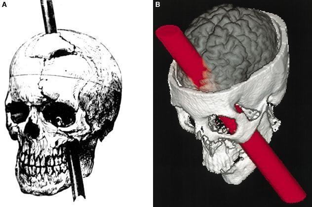 ONLY IN FEMALES SLIDES Phineas Gage In 1848 in Vermont, had a 3.5-foot long, 13 lb.