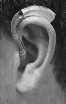 For proper insertion, the goal is to have the length of the ear tube flush with your temple.