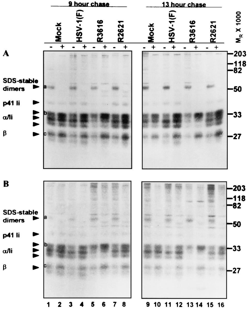 6982 TRGOVCICH ET AL. J. VIROL. FIG. 9. Autoradiographic image of electrophoretically separated MHC class II complexes synthesized prior to infection and immunoprecipitated with antibody DA6.