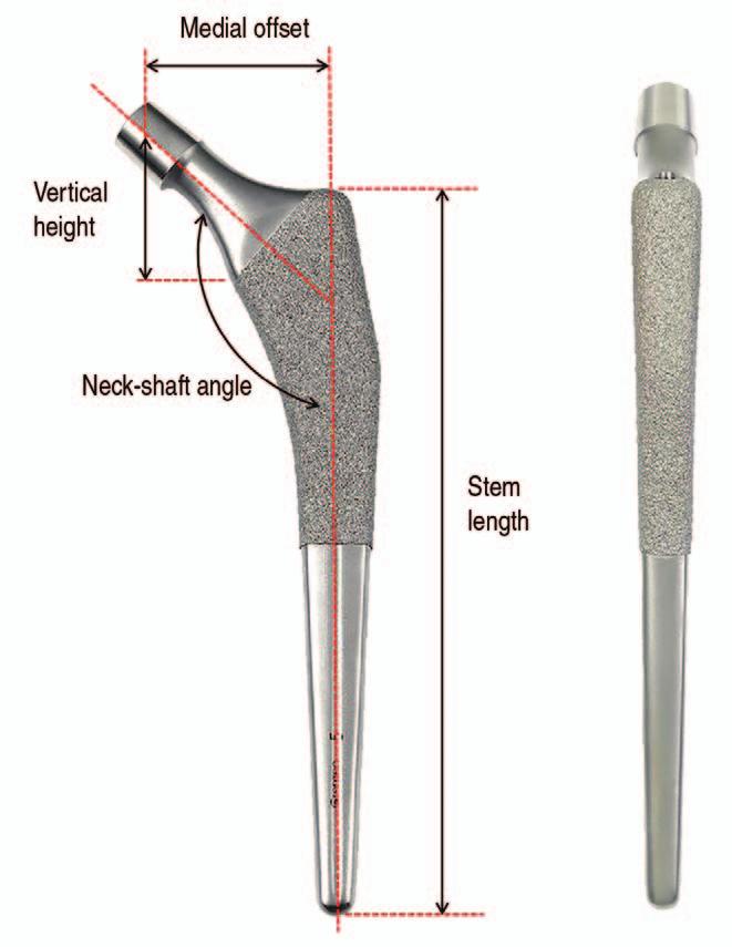 Jung Taek Kim et al. Implant Design in Cementless Hip Arthroplasty designed not to be extruded from the acetabular cups to prevent direct collisions and damage of the locking mechanisms.