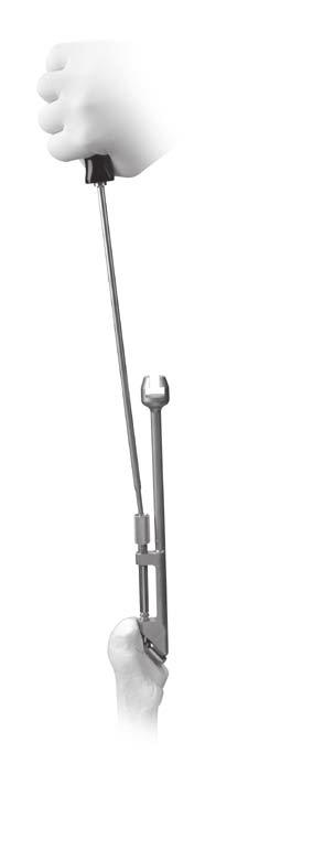 If necessary, a stem extractor to remove the femoral stem components is included in the revision instrument set (Fig. 27).