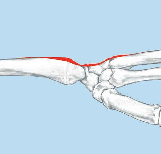 In some cases, the ulnar midcarpal, lunotriquetral and second and third carpometacarpal joints may be included.