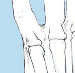 radial aspect of the third metacarpal