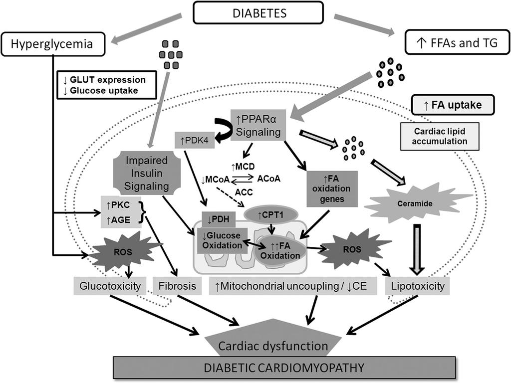 Diabetes and marovasular disease INSULIN RESISTANCE AND DIABETES The onept of myoardial insulin resistane is based on the fat that even in the absene of CAD a dereased in vivo stimulation of