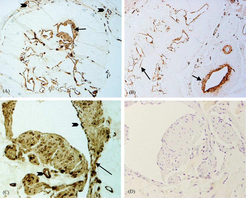 X.-h. Zhang et al. / European Urology 47 (2005) 409 416 413 Fig. 3. Localization of cells immunolabelled with the anti-pde5 antibody in transversal sections of control rat penile tissue.