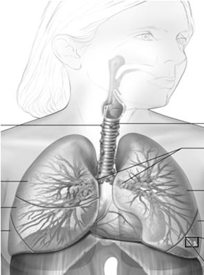 Lung Cancer Work up Endoscopy Bronchoscopy Thoroscopy Mediastinoscopy Laryngoscopy Esophagoscopy Endoscopic ultrasound EUS FNA EBUS Treatment NSCLC Surgery Wedge resection (21) Segmental resection