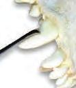 Unless the root is clean the gum will not re-attach. The back surface of the scaler is blunt to minimise damage to the sensitive gingiva.