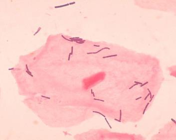 CLASSIFICATION 1. Oral Bacteria Classification has been classified based on Gram s Staining Gram Positive Gram negative 2.