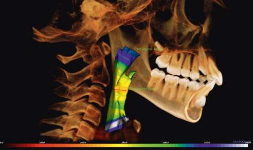 8 second long, low-dose CBCT exposure. Endodontics: Root assessment in three dimensions. Gnathology: Individual mandibular joint diagnosis.