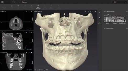 The present: full diagnostics. The future: integrated workflow. Technical specifications. The SmartScan STUDIO acquisiton workflow software will be installed with your OP 3D Vision.