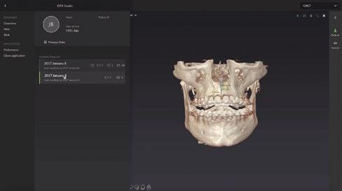 In addition you are already prepared to use the new DTX Studio * unifying software platform for 2D and 3D diagnostics, opening up a whole new era of digital workflow integration.