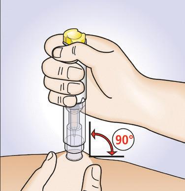 2. Prepare the injectin With yur thumb and frefinger f yur free hand, pinch a pad f skin surrunding the cleaned injectin site by gently squeezing.