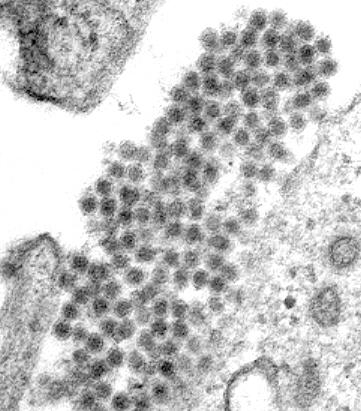 Family Flaviviridae,, Genus Flavivirus, (~68 viruses) ssrna (positive-sense), sense), ~11,000 nucleotides Human pathogens Hemorrhagic fevers (flavi( flavi=yellow) Encephalitis Febrile illness 3