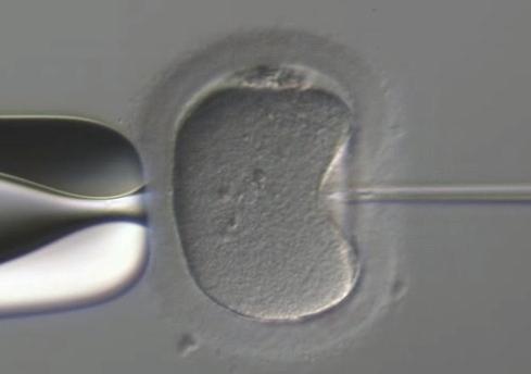 In order to minimize the volume of medium and PVP introduced into the cytoplasm, the transfer capillary is gently withdrawn after the head of the sperm cell has left the pipette tip.