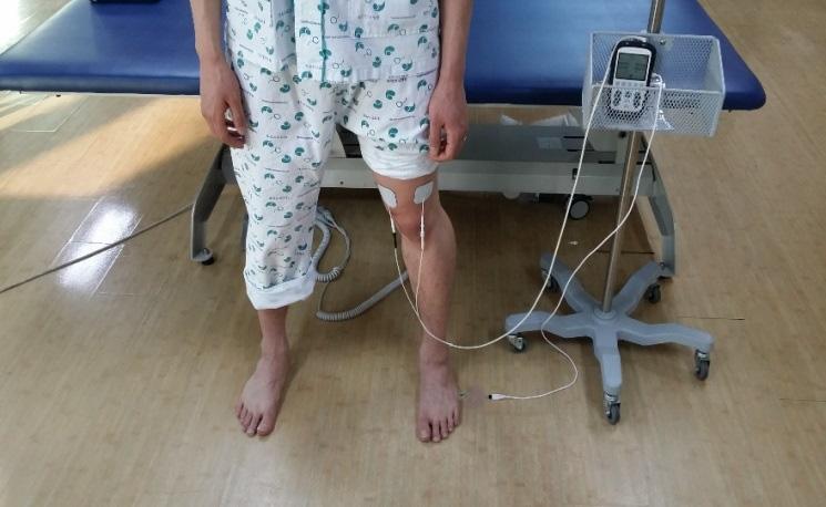 Effect of Weight Shift Training with Electrical Sensory Stimulation Feedback on Standing Balance in Stroke patients 259 electrical stimulation (FES) therapeutic unit (Novastim CU-FS1, CU Medical