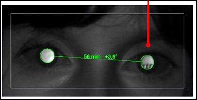 Corneal Reflexes Indicates the degree to which an eye deviates from the parallel eye position.