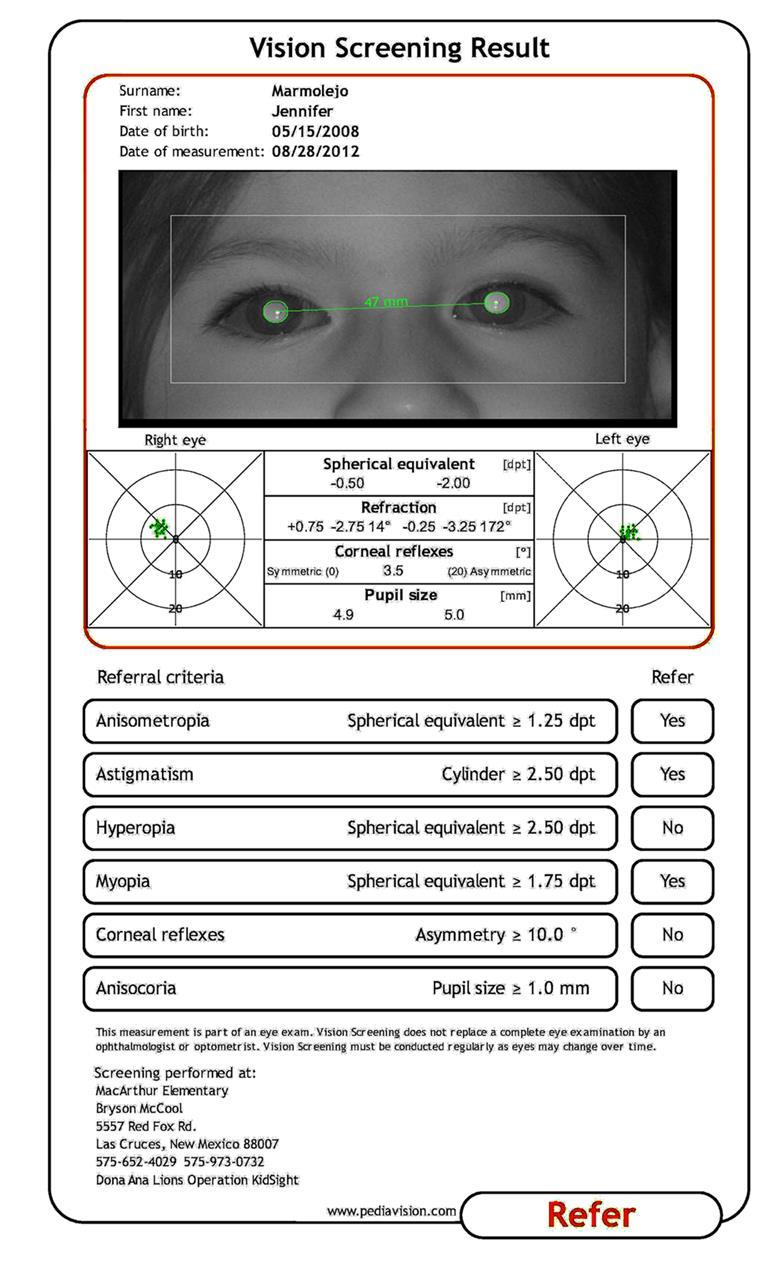 Example of a Plusoptix S09 Measurement Report Specifically identifies possible vision problem(s) the child may have. Provided to the school nurse after screening session.