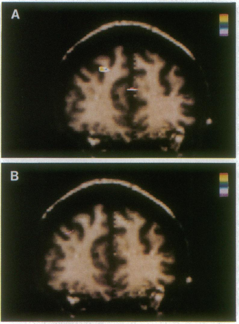 Neurobiology: McCarthy et al. Proc. NatL Acad. Sci. USA 91 (1994) 8693 FIG. 3.