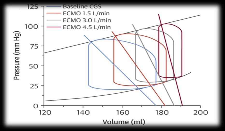 Impact of extracorporeal membrane oxygenation (ECMO) on pressure
